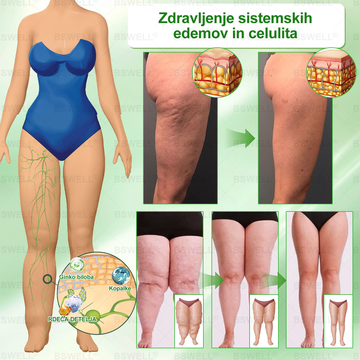 🍀BSWELL® Nano mikroneedling shujševalni obliž (Samo enkrat na dan, vidne spremembe v 28 dneh)  Za debelost, zdravje srca in ožilja,  spalno apnejo, zdravje črevesja, težave s sklepi in še več.🌿