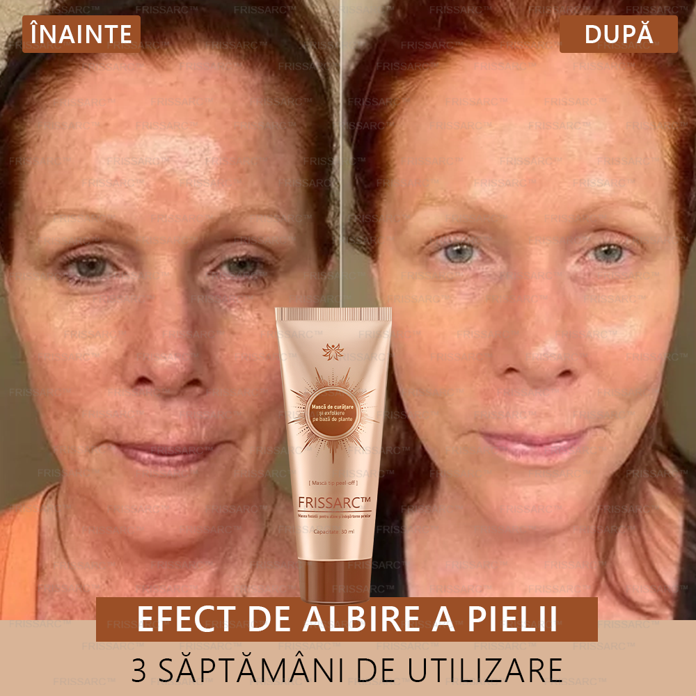 💟FRISSARC™ masca facială  pentru albire și îndepărtarea petelor –🍀Ingredientele naturale ajută la eliminarea eficientă și de durată a petelor pigmentare, petelor de vârstă, pistruilor și petelor solare.🔥🔥